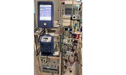 ECMO_foto feita por Thales Cantelle Baggio